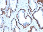 Cytokeratin 13 (Non-Keratinized Squamous Epithelial Marker) Monoclonal Antibody (KRT13/2659)