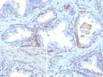 Cytokeratin 13 (Non-Keratinized Squamous Epithelial Marker) Monoclonal Antibody (rKRT13/9623)