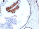 Cytokeratin 13 (Non-Keratinized Squamous Epithelial Marker) Recombinant Rabbit Monoclonal Antibody (KRT13/8577R)