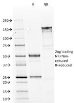 Cytokeratin 14 (KRT14) (Squamous Cell Marker) Antibody in SDS-PAGE (SDS-PAGE)