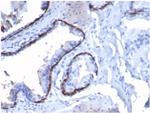 Cytokeratin 14 (KRT14) (Squamous Cell Marker) Antibody in Immunohistochemistry (Paraffin) (IHC (P))