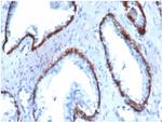 Cytokeratin 14 (KRT14) (Squamous Cell Marker) Antibody in Immunohistochemistry (Paraffin) (IHC (P))