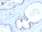 Cytokeratin 14 (KRT14) (Squamous Cell Marker) Antibody in Immunohistochemistry (Paraffin) (IHC (P))