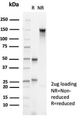 Cytokeratin 14 (KRT14) (Squamous Cell Marker) Antibody in SDS-PAGE (SDS-PAGE)