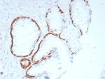 Cytokeratin 14 (KRT14) (Squamous Cell Marker) Antibody in Immunohistochemistry (Paraffin) (IHC (P))