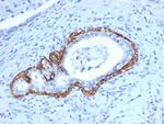 Cytokeratin 14 (KRT14) (Squamous Cell Marker) Antibody in Immunohistochemistry (Paraffin) (IHC (P))