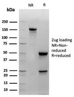 Cytokeratin 14 (KRT14) (Squamous Cell Marker) Antibody in SDS-PAGE (SDS-PAGE)