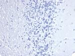 Cytokeratin 14 (KRT14) (Squamous Cell Marker) Recombinant Rabbit Monoclonal Antibody (KRT14/4584R)