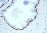 Cytokeratin 14 (KRT14) (Squamous Cell Marker) Antibody in Immunohistochemistry (Paraffin) (IHC (P))