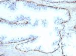Cytokeratin 14 (KRT14) (Squamous Cell Marker) Antibody in Immunohistochemistry (Paraffin) (IHC (P))