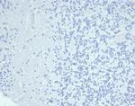 Cytokeratin 14 (KRT14) (Squamous Cell Marker) Antibody in Immunohistochemistry (Paraffin) (IHC (P))