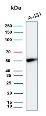 Cytokeratin 14 (KRT14) (Squamous Cell Marker) Antibody in Western Blot (WB)