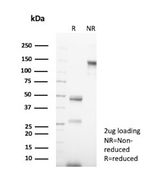 Cytokeratin 14 (KRT14) (Squamous Cell Marker) Antibody in SDS-PAGE (SDS-PAGE)