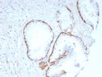 Cytokeratin 14 (KRT14) (Squamous Cell Marker) Antibody in Immunohistochemistry (Paraffin) (IHC (P))