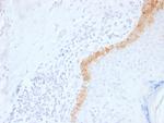 Cytokeratin 15 (Esophageal Squamous Cell Carcinoma Marker) Antibody in Immunohistochemistry (Paraffin) (IHC (P))