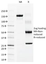 Cytokeratin 15 (Esophageal Squamous Cell Carcinoma Marker) Antibody in SDS-PAGE (SDS-PAGE)