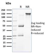 Cytokeratin 15 (Esophageal Squamous Cell Carcinoma Marker) Antibody in SDS-PAGE (SDS-PAGE)