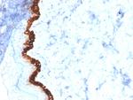 Cytokeratin 15 (Esophageal Squamous Cell Carcinoma Marker) Monoclonal Antibody (KRT15/2554)