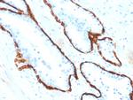 Cytokeratin 15 (Esophageal Squamous Cell Carcinoma Marker) Antibody in Immunohistochemistry (Paraffin) (IHC (P))