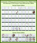 Cytokeratin 15 (Esophageal Squamous Cell Carcinoma Marker) Antibody in Immunohistochemistry (Paraffin) (IHC (P))