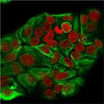 Cytokeratin 15 (Esophageal Squamous Cell Carcinoma Marker) Monoclonal Antibody (KRT15/2957)