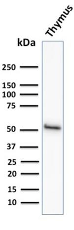 Cytokeratin 15 Antibody in Western Blot (WB)