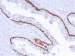 Cytokeratin 15 (Esophageal Squamous Cell Carcinoma Marker) Antibody in Immunohistochemistry (Paraffin) (IHC (P))