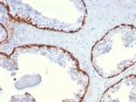 Cytokeratin 15 (Esophageal Squamous Cell Carcinoma Marker) Antibody in Immunohistochemistry (Paraffin) (IHC (P))