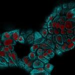 Cytokeratin 15 (Esophageal Squamous Cell Carcinoma Marker) Antibody in Immunocytochemistry (ICC/IF)