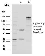 Cytokeratin 15 (Esophageal Squamous Cell Carcinoma Marker) Antibody in SDS-PAGE (SDS-PAGE)