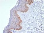 Cytokeratin 15 (Esophageal Squamous Cell Carcinoma Marker) Recombinant Rabbit Monoclonal Antibody (KRT15/8312R)