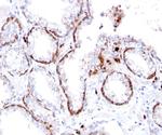 Cytokeratin 15 (Esophageal Squamous Cell Carcinoma Marker) Recombinant Rabbit Monoclonal Antibody (KRT15/2103R)