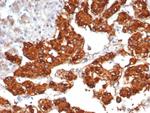 Interleukin-31/IL-33 Monoclonal Antibody (IL31/7333)