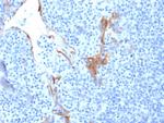 Cytokeratin 16 (KRT16) (Suprabasal Keratinocyte Marker) Monoclonal Antibody (LL025)