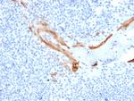 Cytokeratin 16 (KRT16) (Suprabasal Keratinocyte Marker) Monoclonal Antibody (SPM264)