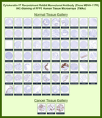 Cytokeratin 17 (CK17) (Basal Epithelial Marker) Antibody in Immunohistochemistry (Paraffin) (IHC (P))