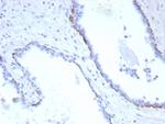 Cytokeratin 17 (CK17) (Basal Epithelial Marker) Recombinant Rabbit Monoclonal Antibody (KRT17/8320R)
