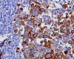 Cytokeratin 17 (CK17) (Basal Epithelial Marker) Recombinant Rabbit Monoclonal Antibody (KRT17/8346R)