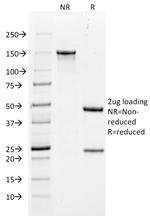 Cytokeratin 18 (KRT18) Antibody in SDS-PAGE (SDS-PAGE)