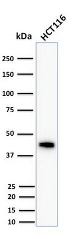 Cytokeratin 18 (KRT18) Antibody in Western Blot (WB)