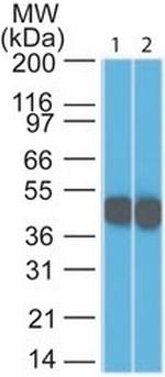 Cytokeratin 18 (KRT18) Antibody in Western Blot (WB)