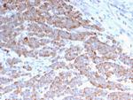 Cytokeratin 18 (KRT18) Antibody in Immunohistochemistry (Paraffin) (IHC (P))
