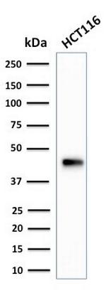 Cytokeratin 18 (KRT18) Antibody in Western Blot (WB)