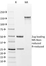 Cytokeratin 18 (KRT18) Antibody in SDS-PAGE (SDS-PAGE)