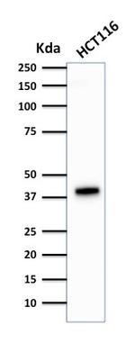 Cytokeratin 18 (KRT18) Antibody in Western Blot (WB)