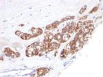 Cytokeratin 18 (KRT18) Antibody in Immunohistochemistry (Paraffin) (IHC (P))