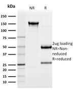 Cytokeratin 18 (KRT18) Antibody in SDS-PAGE (SDS-PAGE)
