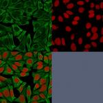 Cytokeratin 18 (KRT18) Antibody in Immunocytochemistry (ICC/IF)