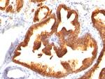 Cytokeratin 18 (KRT18) Antibody in Immunohistochemistry (Paraffin) (IHC (P))
