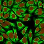 Cytokeratin 18 (KRT18) Antibody in Immunocytochemistry (ICC/IF)